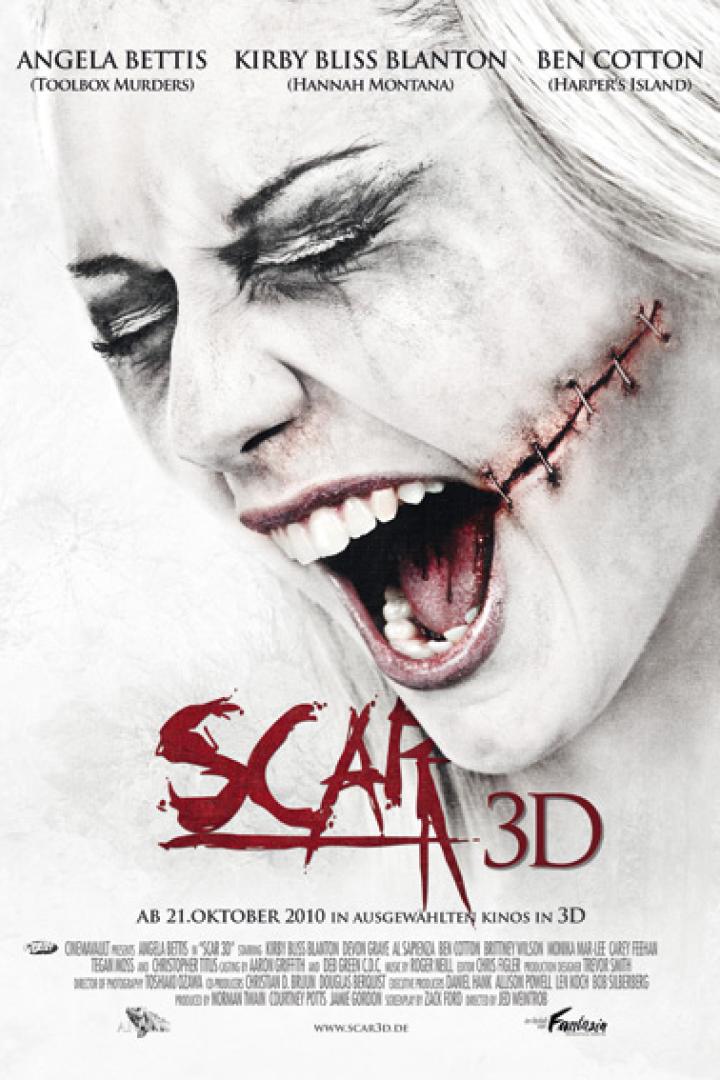 Scar 3D