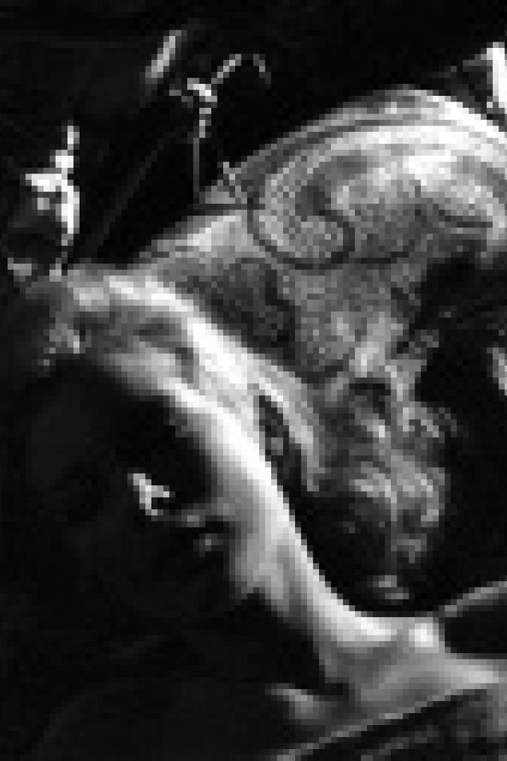 Eine junge Frau liegt in einem dunklen Raum auf einem verzierten Bett.