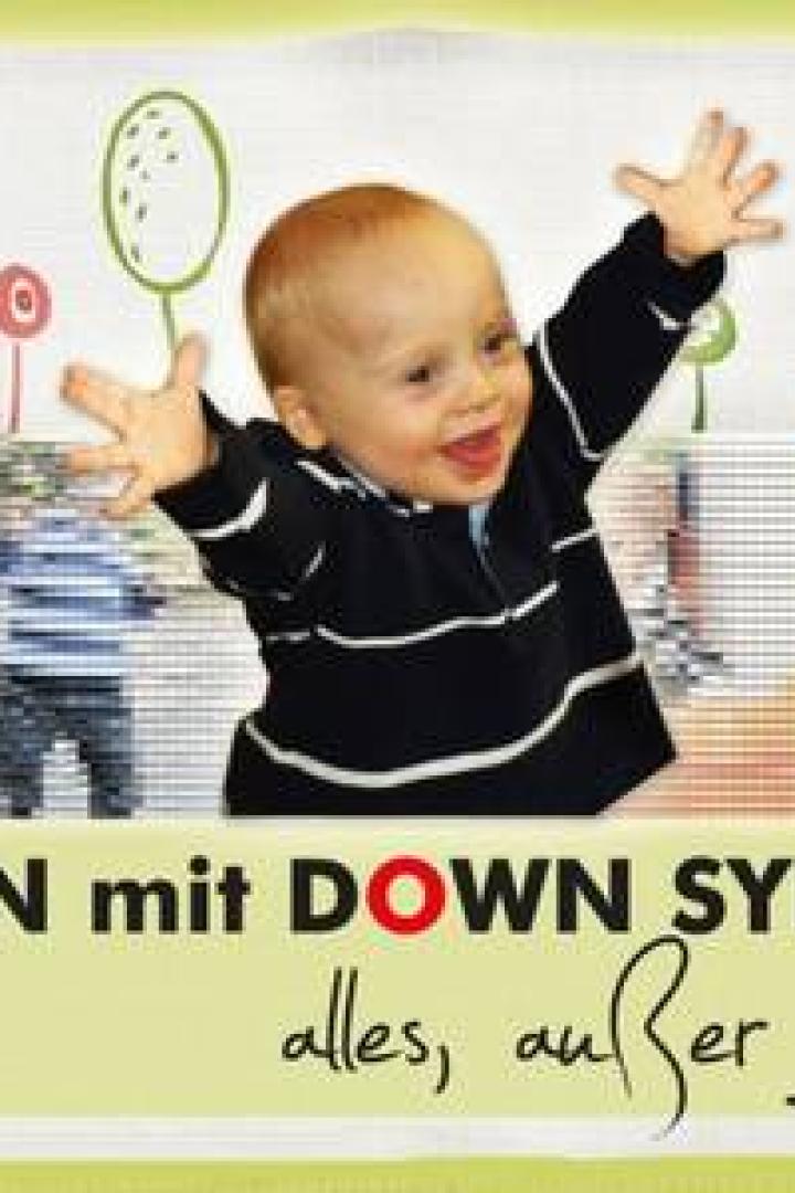 Ein lächelnder Säugling mit Down-Syndrom streckt die Arme aus.