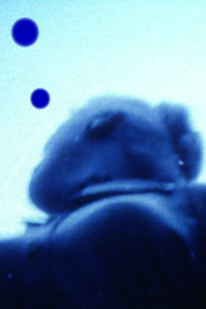 Eine Person blickt in den Himmel, wo blaue Kreise zu sehen sind.