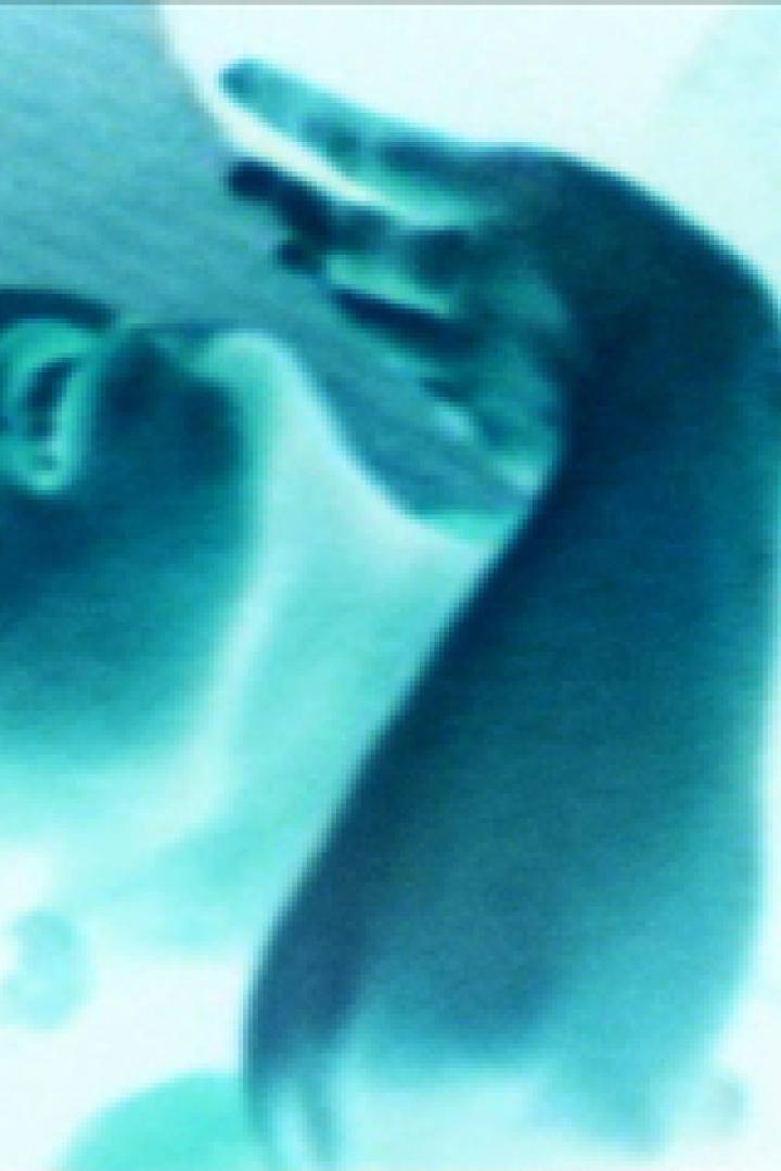 Eine Person liegt auf dem Rücken und streckt eine Hand aus.