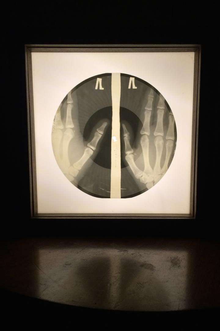 Ein Röntgenbild von zwei Händen, die ein Friedenszeichen formen, in einem Rahmen.