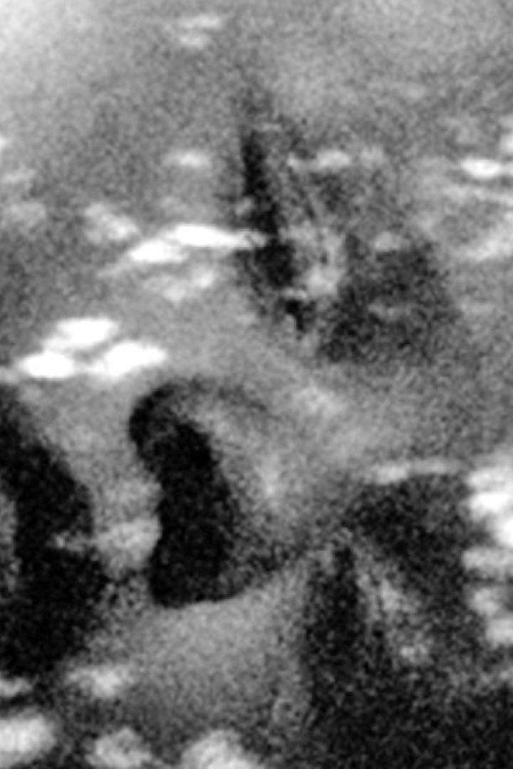 Nahaufnahme eines Gesichtes im Schatten mit Lichtflecken.