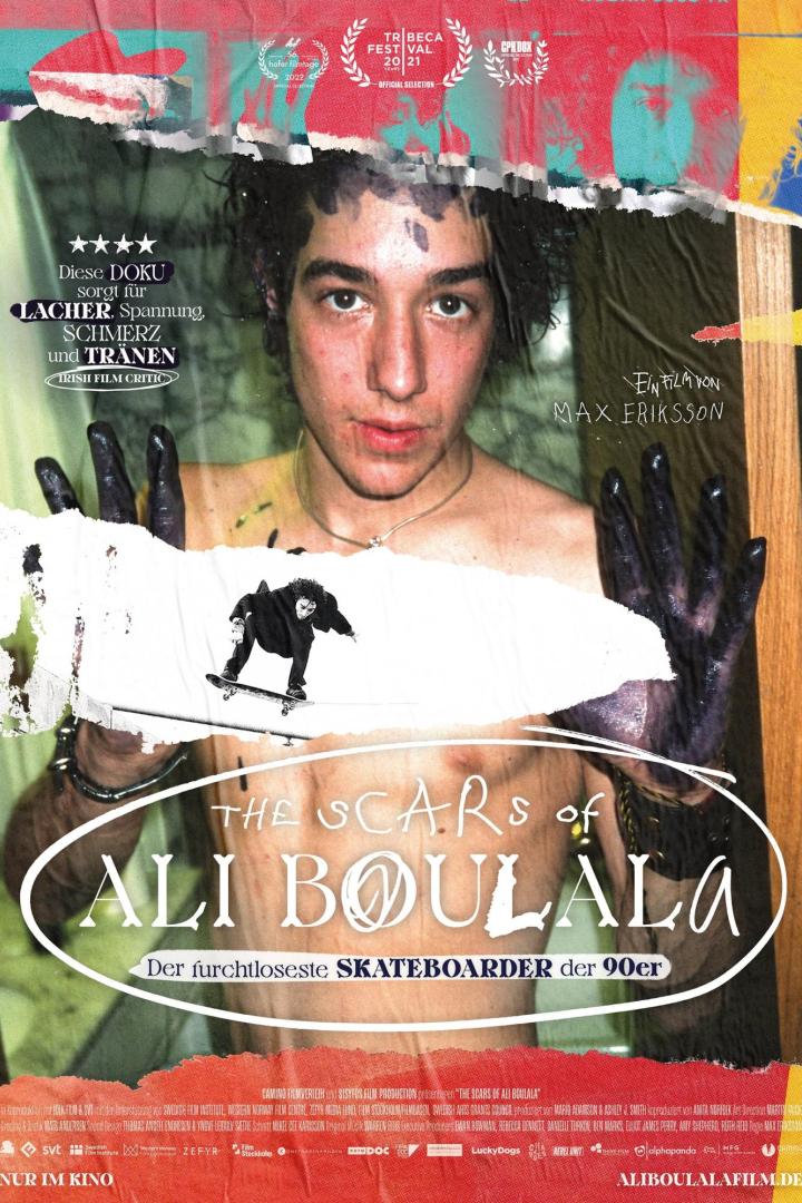 The Scars of Ali Boulala