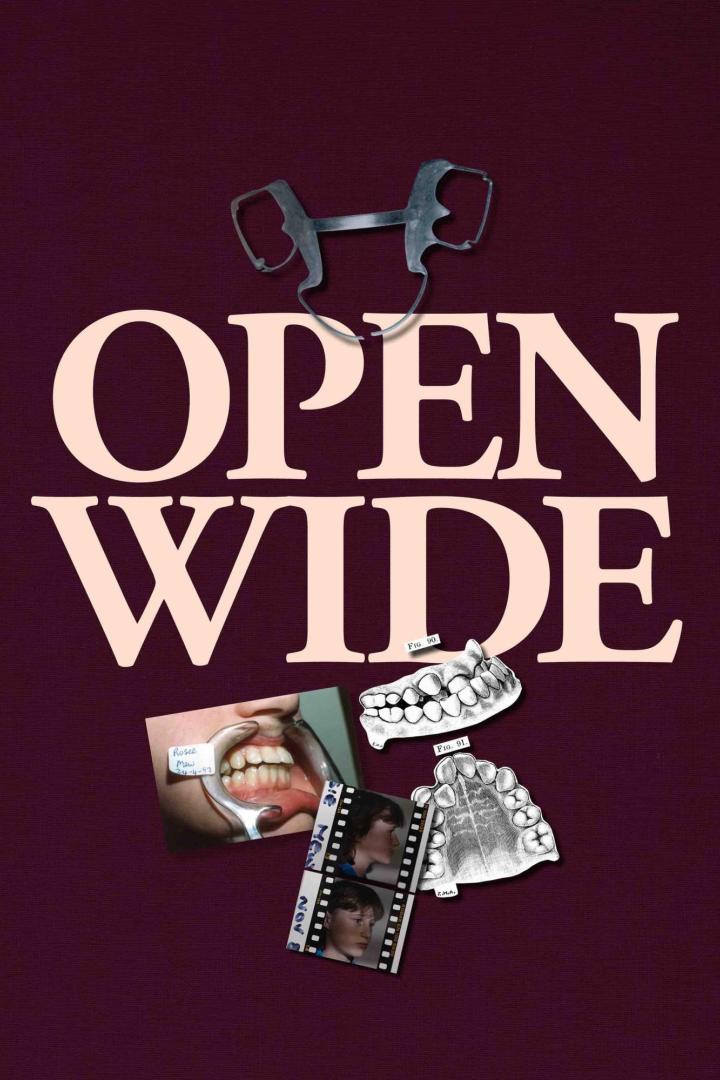 Das Poster zeigt zahnmedizinische Bilder und den Text „Open Wide“.