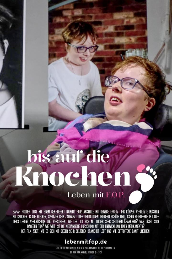 Bis auf die Knochen - Leben mit FOP