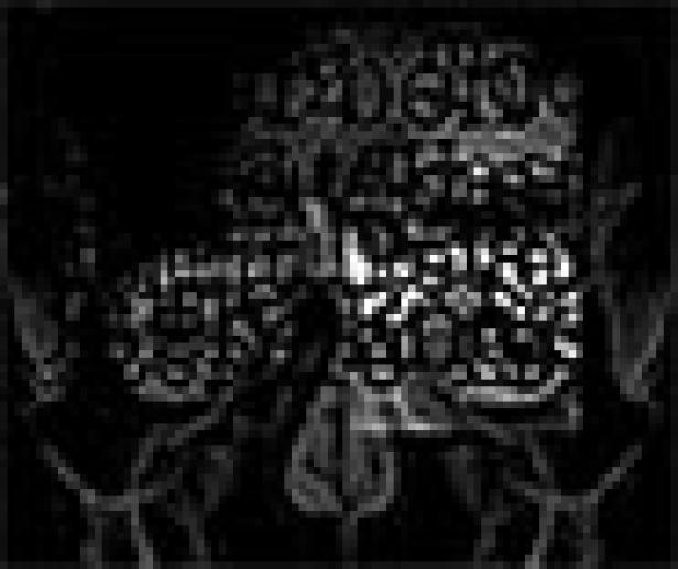 Eine stilisierte Darstellung eines Schädels mit floralen Elementen.