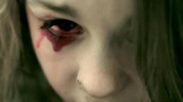 Nahaufnahme eines Mädchens mit Blut, das aus ihrem Auge läuft.