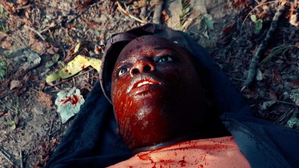 Eine verletzte Person liegt mit blutverschmiertem Gesicht im Laub.