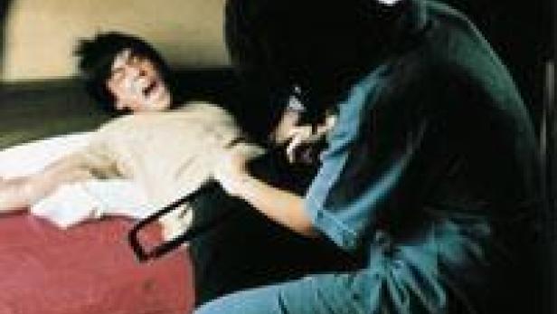 Eine Person in medizinischer Kleidung sägt mit einer Bügelsäge den Arm einer schreienden Person ab.