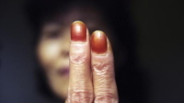 Nahaufnahme von zwei Fingern mit roten Nagelbetten vor einem unscharfen Hintergrund.