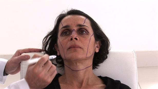 Eine Frau hat Markierungen auf ihrem Gesicht, vermutlich vor einer Schönheitsoperation.