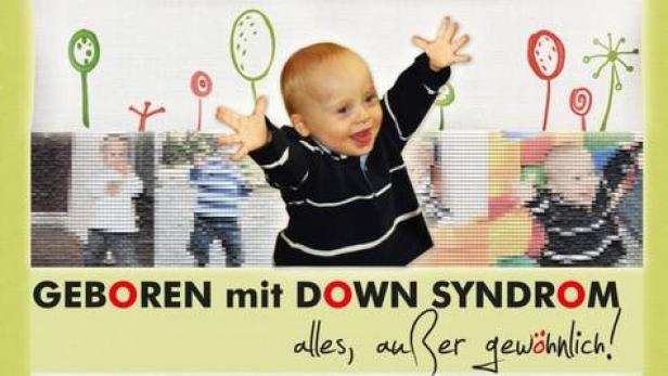 Ein lächelnder Säugling mit Down-Syndrom streckt die Arme aus.