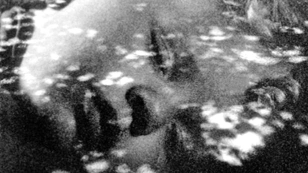 Nahaufnahme eines Gesichtes im Schatten mit Lichtflecken.