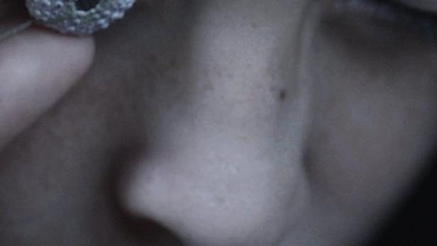 Das Filmplakat für „Alba“ zeigt das Gesicht eines Mädchens mit einem Seeigel vor dem Auge.