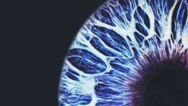 Nahaufnahme eines blau gefärbten menschlichen Auges.