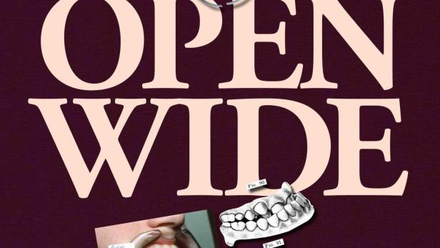 Das Poster zeigt zahnmedizinische Bilder und den Text „Open Wide“.