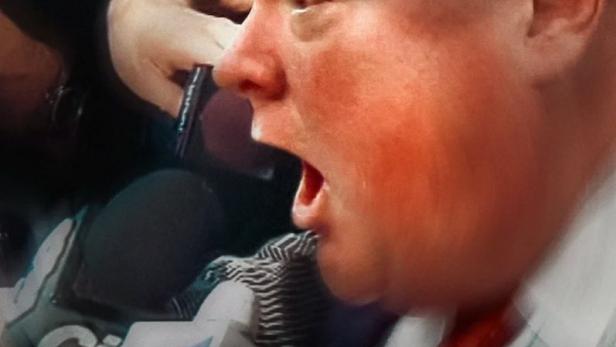 Ein Mann mit offenem Mund wird von Mikrofonen umringt.