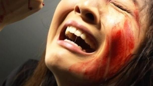 Eine verletzte Frau mit einem fehlenden Auge schreit vor Schmerz.